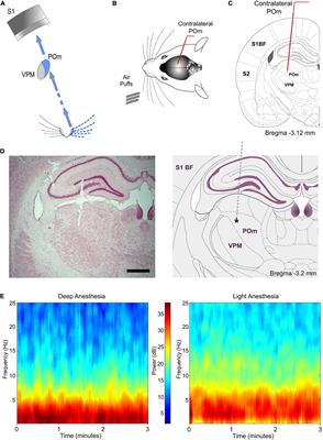 Higher-Order Thalamic Encoding of Somatosensory Patterns and Bilateral Events